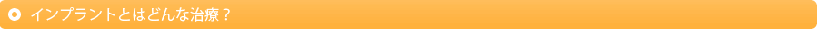 インプラントとはどんな治療？